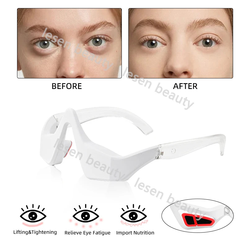 Eye Beauty Device with Hot Compress